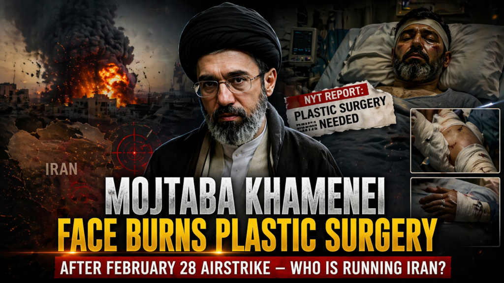 Mojtaba Khamenei face burns plastic surgery after February 28 airstrike Iran health update