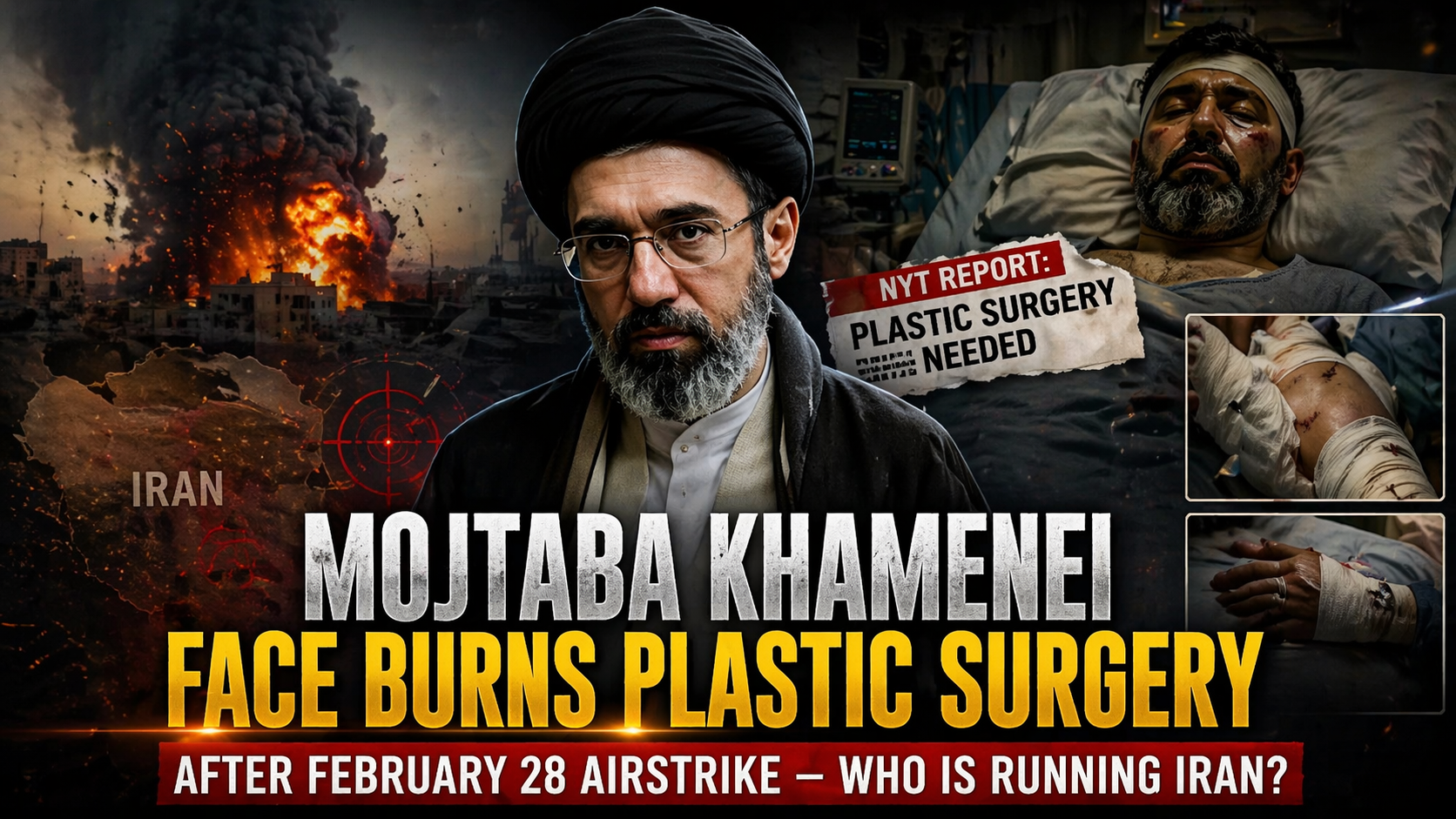 Mojtaba Khamenei face burns plastic surgery after February 28 airstrike Iran health update
